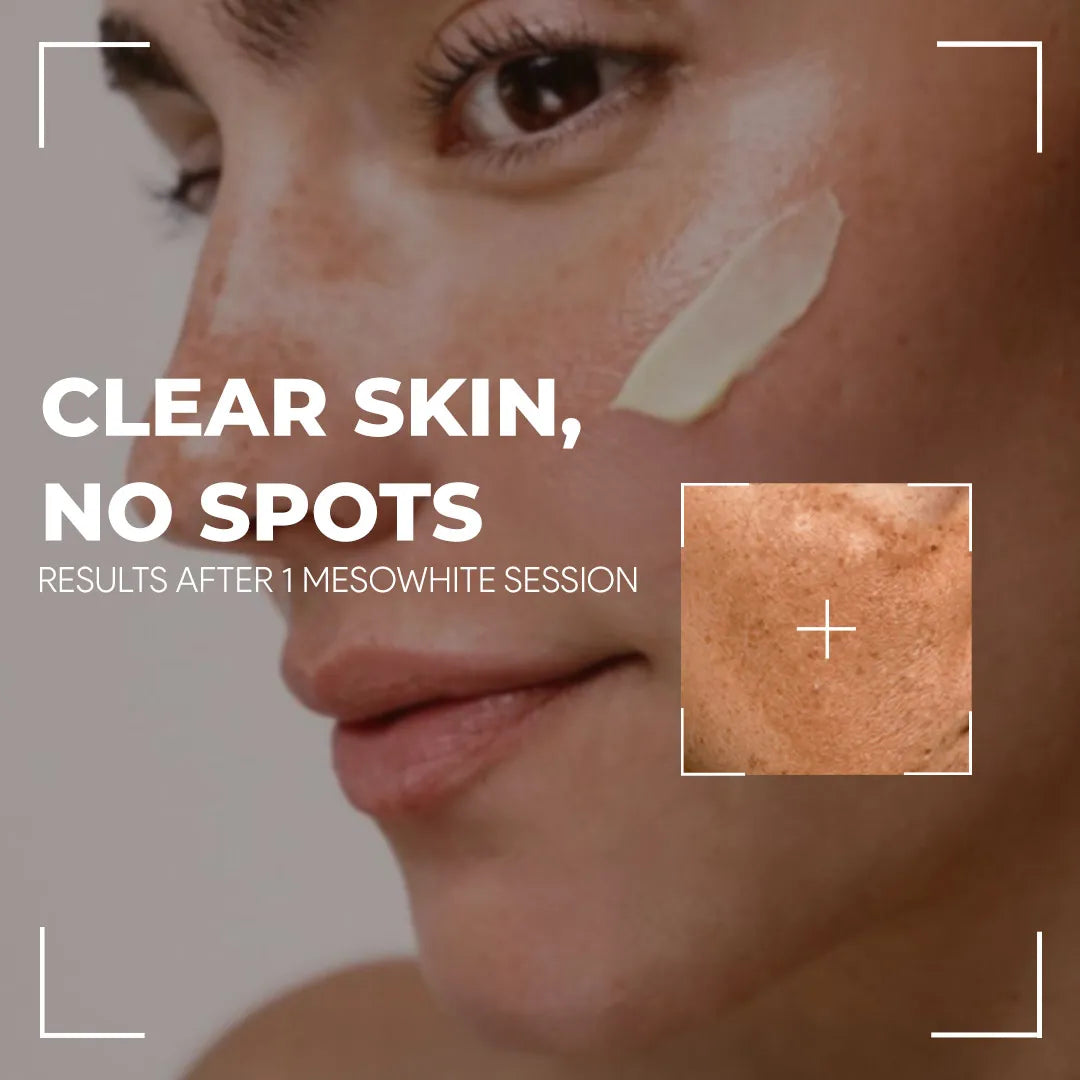 Seyoul™ Meso White- Black Friday Flash Sale