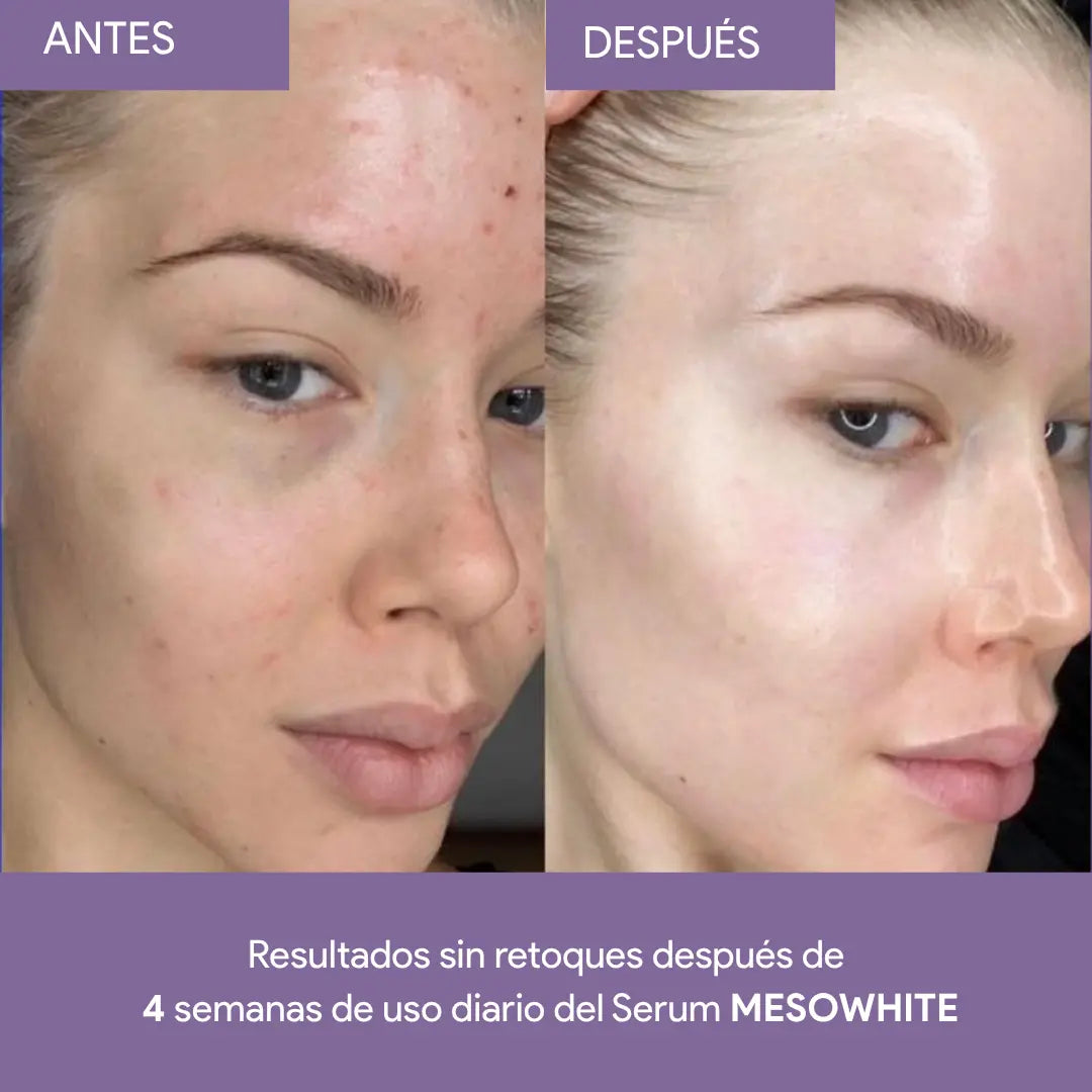 Células madre Mesowhite