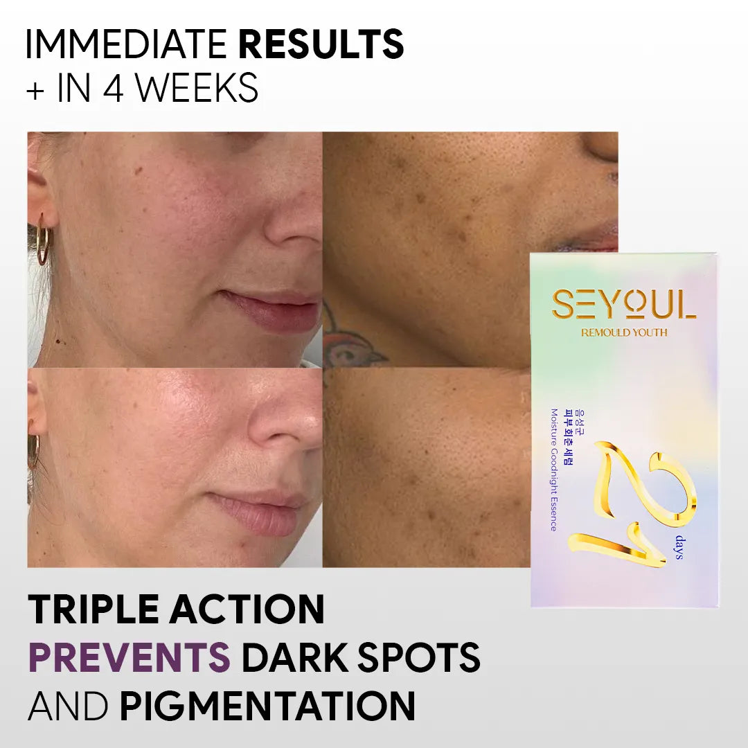 Seyoul™ Serum 21 Days- Black Friday Flash Sale