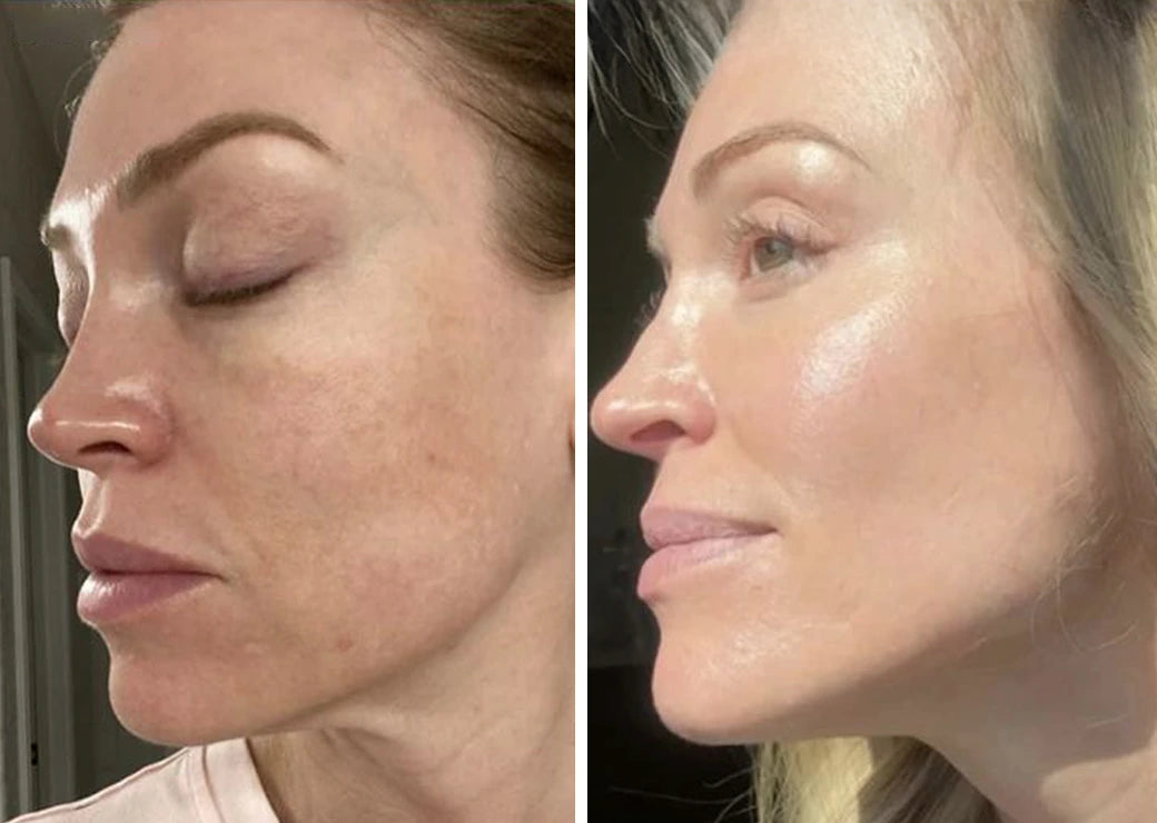 Seyoul™ Collagen Wrapping Mask