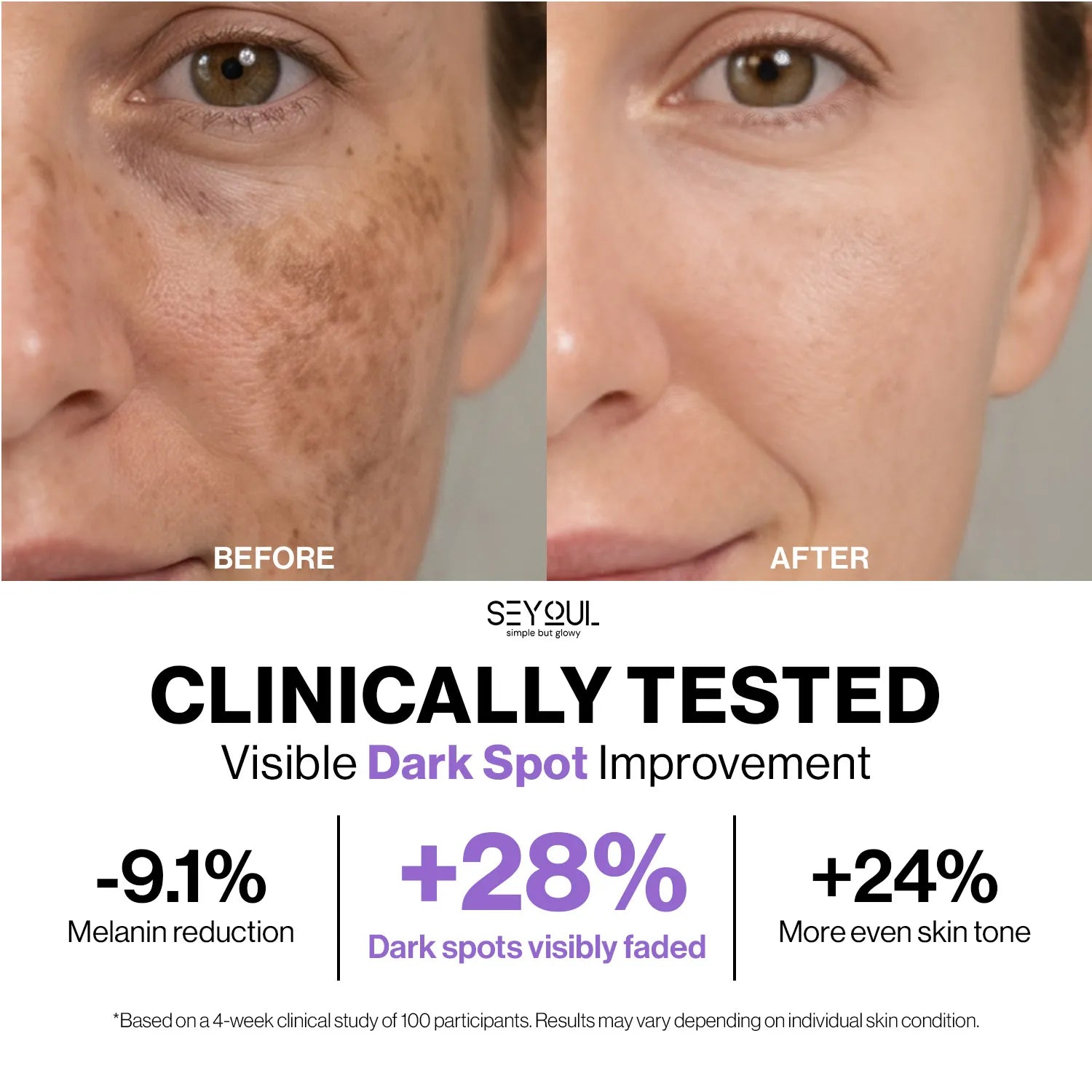 Seyoul™ Meso White