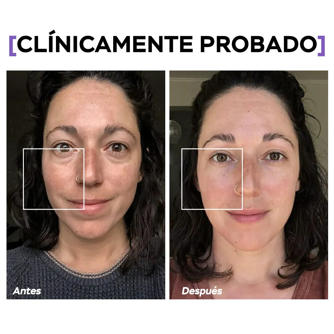 Seyoul™ Células madre Mesowhite