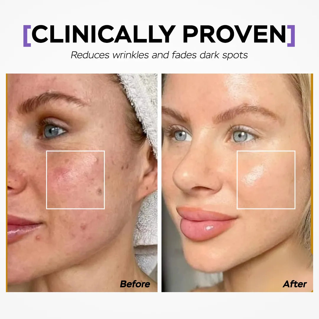 Seyoul™ Collagen Jelly Mask